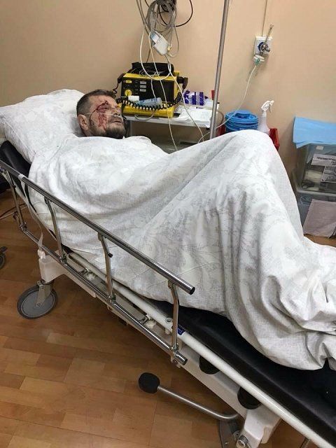 В результате взрыва нардеп Мосийчук ранен, два человека погибли
