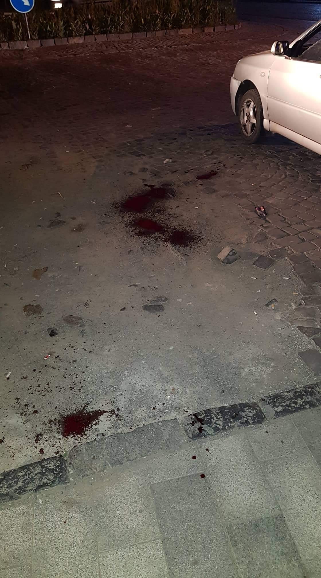 В Ужгороде на Корятовича человек истекал кровью (ФОТОФАКТ)