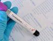 Чехія стала коронавірусною — зафіксовані перші три випадки зараження COVID-19