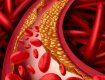  Тромбы - сгустки крови, которые могут стать причиной инфаркта, инсульта или тромбоза