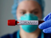 В Закарпатье установлен абсолютный антирекорд по коронавирусу за последние сутки 