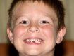 В Ужгороде внедряют программу оздоровления зубов детей