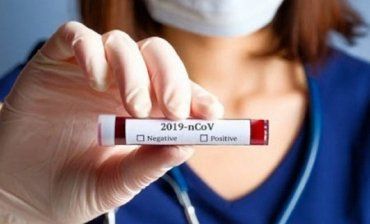 За минулу добу на Закарпатті підтверджено коронавірус у 479 пацієнтів!